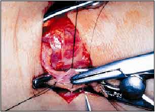 ������������ ��������������� �������