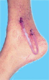 ��������������� ����